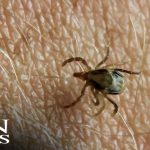 ER Visits for Tick Bites Surge - Are You at Risk?