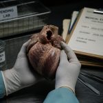 Prelim Report: Sen. Lindsey Graham Died of Aortic Dissection