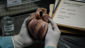 Prelim Report: Sen. Lindsey Graham Died of Aortic Dissection